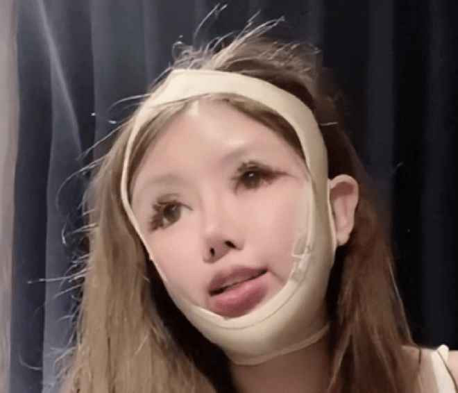 Zhou đã phải tiêm nhiều loại thuốc thúc đẩy tăng trưởng khi nâng ngực, điều này đã làm cô không thể nuôi con bằng sữa mẹ sau này.