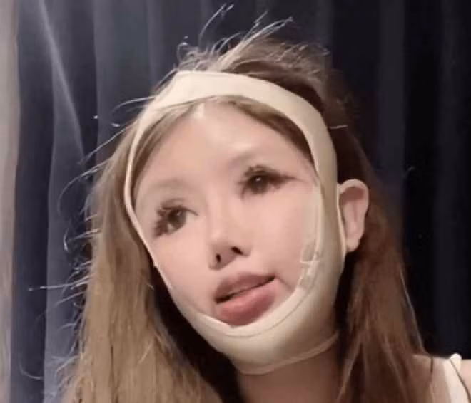 Zhou đã phải tiêm nhiều loại thuốc thúc đẩy tăng trưởng khi nâng ngực, điều này đã làm cô không thể nuôi con bằng sữa mẹ sau này.