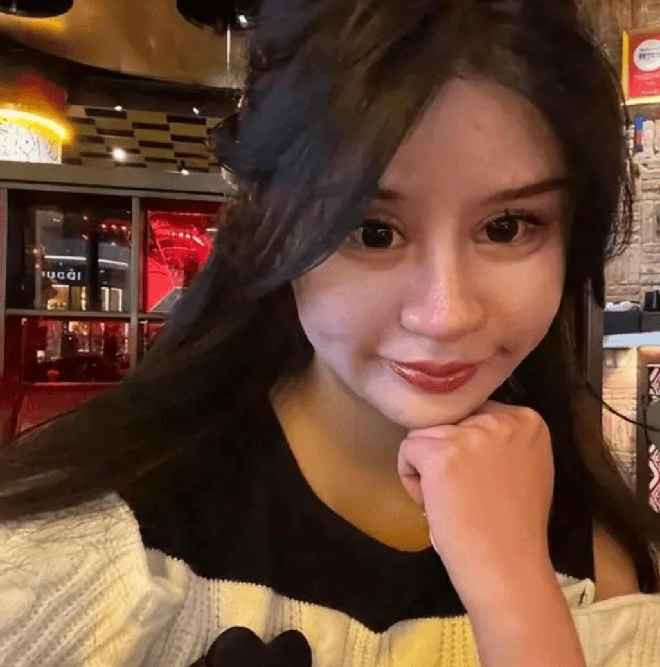 Trải qua quá nhiều đau đớn về thể xác lẫn tinh thần qua 200 cuộc phẫu thuật, Zhou Chuna cảm thấy hối hận vì đã hành hạ cơ thể, khiến cô thực sự không nhận ra bản thân.