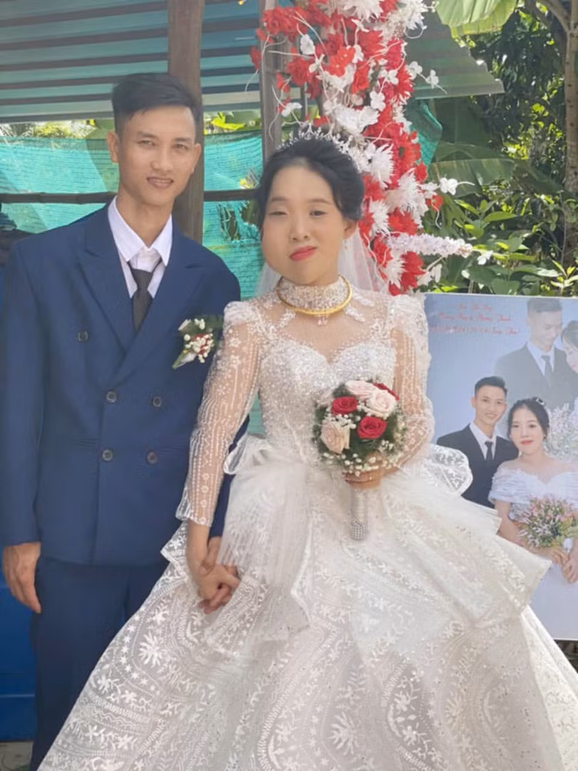 Câu chuyện tình yêu giữa Trần Thị Phương Thanh (SN 2003, quê Đắk Lắk) và Hoàng Huy (SN 2003, quê Sóc Trăng) được nhiều người gọi là "chuyện tình đũa lệch" bởi cô dâu Phương Thanh có gương mặt sưng lệch bên phải, chân bị bên to bên nhỏ, trong khi chú rể lại hoàn toàn bình thường. (Ảnh: NVCC)