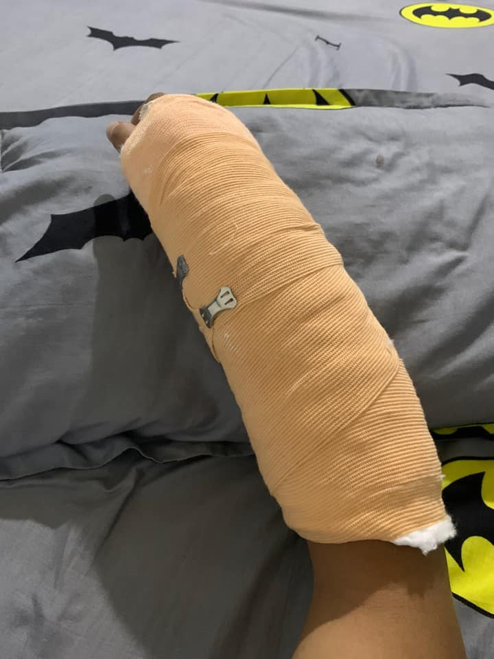 Thậm chí còn có cả hình ảnh băng bó tay...