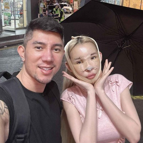 “Trời ơi tức quá, tai vểnh đợt này làm cũng mấy chục củ à chứ đâu có rẻ, tại vì Ngân làm ở bên Hàn mà. Mà làm xong vậy đó, là vểnh dữ chưa nè”, Ngân 98 thất vọng chia sẻ.