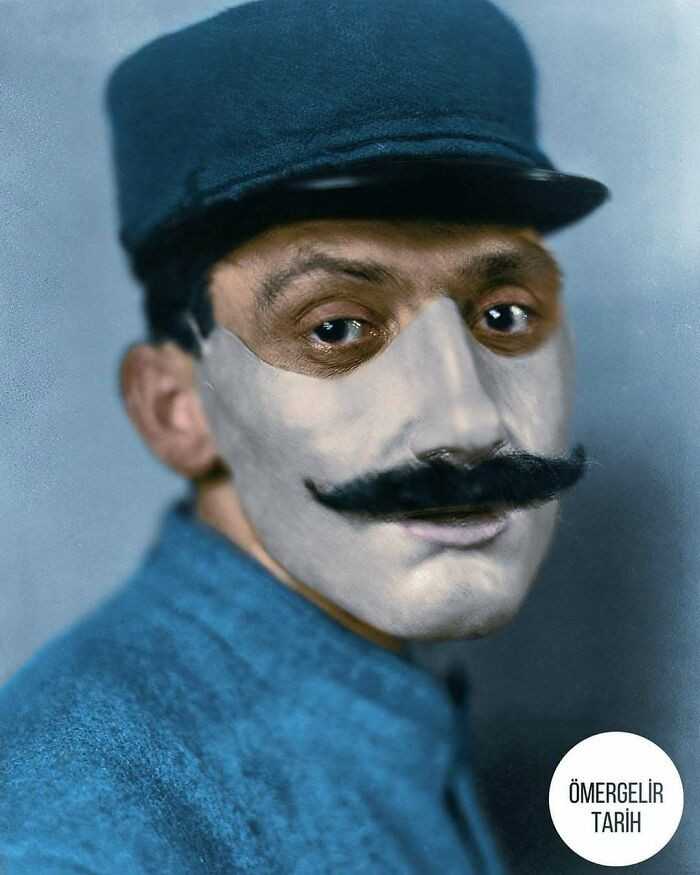 Một người lính Pháp với khuôn mặt giả năm 1918.