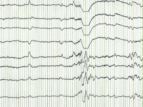 Co the biet nhung bi mat thong qua viec quet song nao-Hinh-2