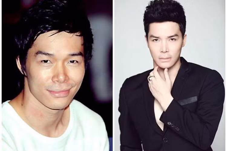 Siêu mẫu quốc tế đình đám Nathan Lee cũng từng khiến công chúng ngạc nhiên khi nhan sắc của anh có sự thay đổi từng ngày đẹp lên trông thấy, nhất là đôi mắt của anh. Nếu trước đây Nathan Lee sở hữu đôi mắt một mí thì hình ảnh hiện tại, đôi mắt này “hóa” hai mí. Điều đó khiến siêu mẫu này có tên trong danh sách những nghệ sĩ bị nghi ngờ phẫu thuật thẩm mỹ.