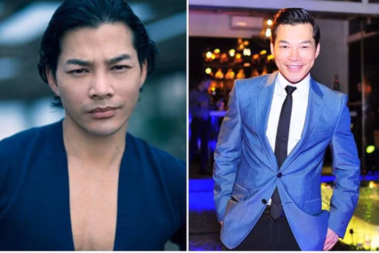 Diễn viên Trần Bảo Sơn cũng nằm trong danh sách nghi vấn từng đụng dao kéo có diễn viên – doanh nhân Trần Bảo Sơn. Chiếc cằm của anh nhìn dài, nhọn trông thấy và làn da của nam diễn viên cũng có phần trắng trẻo hơn trước. Dù rằng chưa có bằng chứng xác thực cho việc liệu Trần Bảo Sơn có đụng dao kéo hay không, nhưng có thể dễ dàng nhận thấy ngoại hình anh thay đổi và ngày càng sáng hơn. 