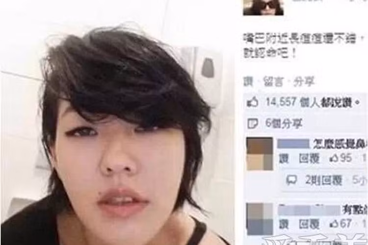 Trong bức hình này, Tiểu S trông mất cân đối với vùng mũi xô lệch. Tuy nhiên, nữ MC đã phủ nhận tin đồn “dao kéo”. 