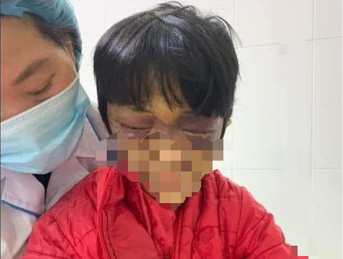 Be gai 6 tuoi bi me de dang mang thai bao hanh da man