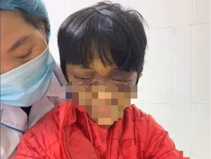 Be gai 6 tuoi bi me de dang mang thai bao hanh da man