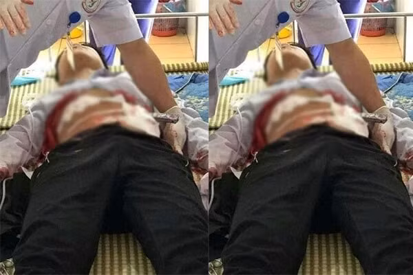 Tin nong ngay 21/3: Giai cuu 3 nu nhan vien karaoke bi nhot trong phong tro danh dap-Hinh-2