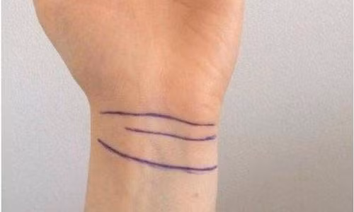 Người có 2 – 3 nếp gấp ở cổ tay còn có sức khỏe tốt, hiếm khi đau ốm. Nhờ thế, họ có thể tập trung phát triển sự nghiệp với nguồn năng lượng tích cực nhất - Ảnh minh họa: Internet