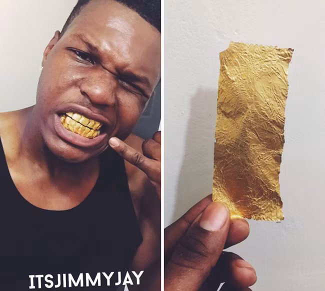 Cách để có bộ "răng vàng" sống ảo trên mạng.