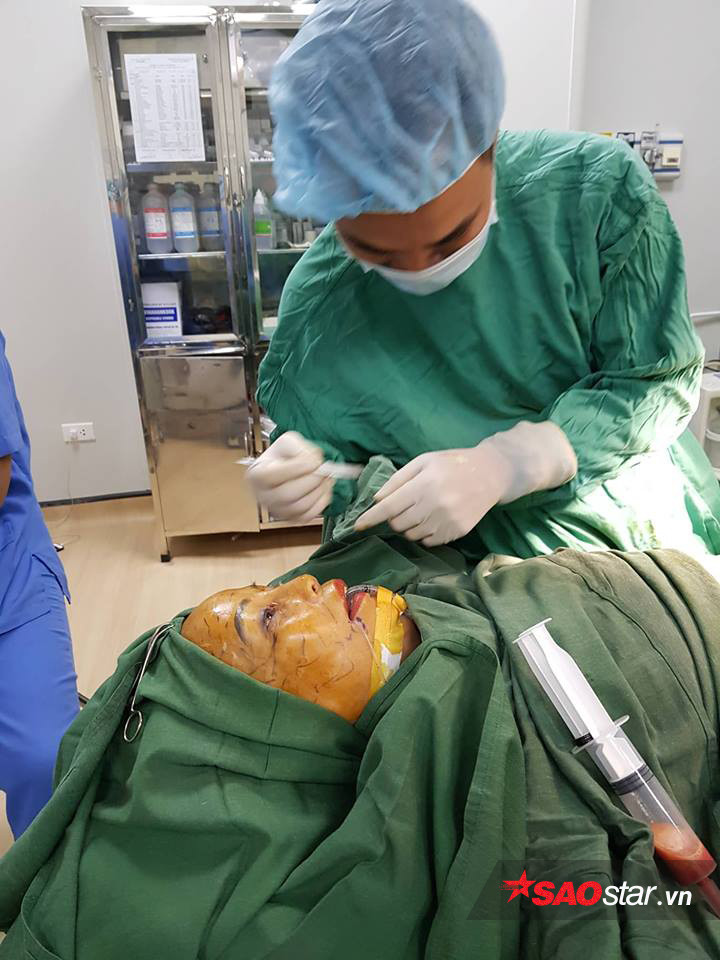 Dien mao moi gay bat ngo cua co dau 61 sau phau thuat