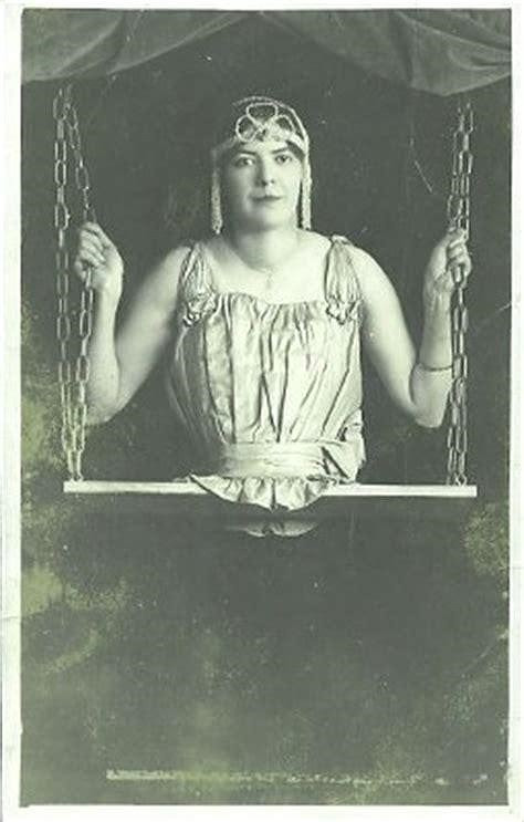 Mademoiselle Gabrielle là một người không chân đã nổi tiếng vào đầu những năm 1900.