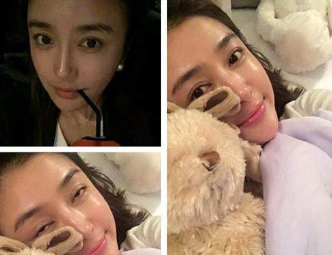 Khó mà phủ nhận việc Tần Lam đã từng lạm dụng dao kéo trong quá khứ.