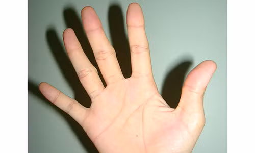 Nhin ke ho ban tay biet ngay tuong lai sang hen