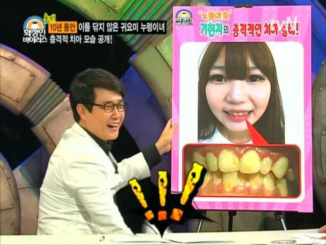 Gai tre Han Quoc gay soc voi thoi quen 10 nam khong danh rang-Hinh-2