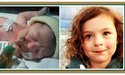 Maisy Vignes lúc mới sinh (trái) và hiện tại (phải).