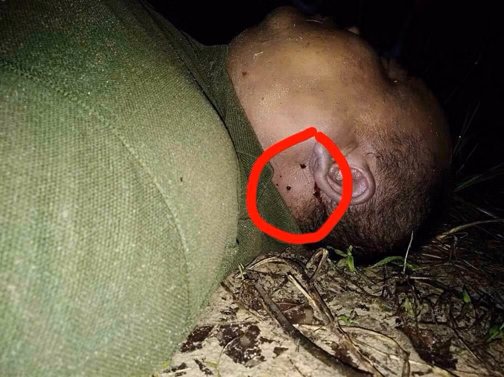 Vết cắn của hổ mang chúa bên dưới tai trái nạn nhân xấu số.