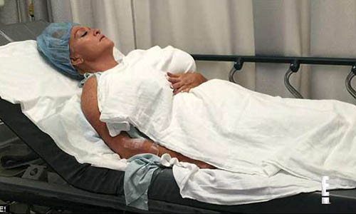 Allegra Cole sau một ca phẫu thuật bơm ngực.