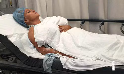 Allegra Cole sau một ca phẫu thuật bơm ngực.