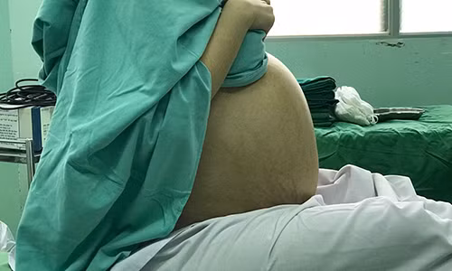 Bụng to bất thường của cô gái 20 tuổi.