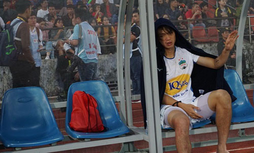 Tuấn Anh buồn bã khi lại tái phát chấn thương.