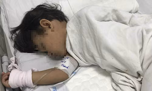 Bé U. đang điều trị tại BV Nhi đồng TP. Ảnh: HL