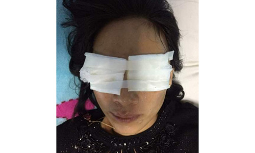 Chị Nguyễn Thị Hằng bị mẹ chồng Lê Thị An tạt axít. (Ảnh DV)