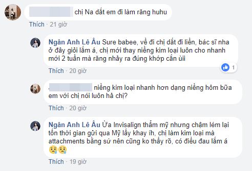 Lê Âu Ngân Anh vô tình thừa nhận mới đi niềng răng.