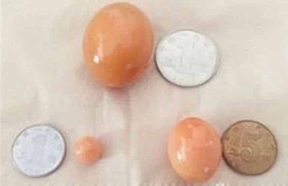 Những viên ngọc Melody trong con ốc vàng, to nhất bằng quả trứng gà.