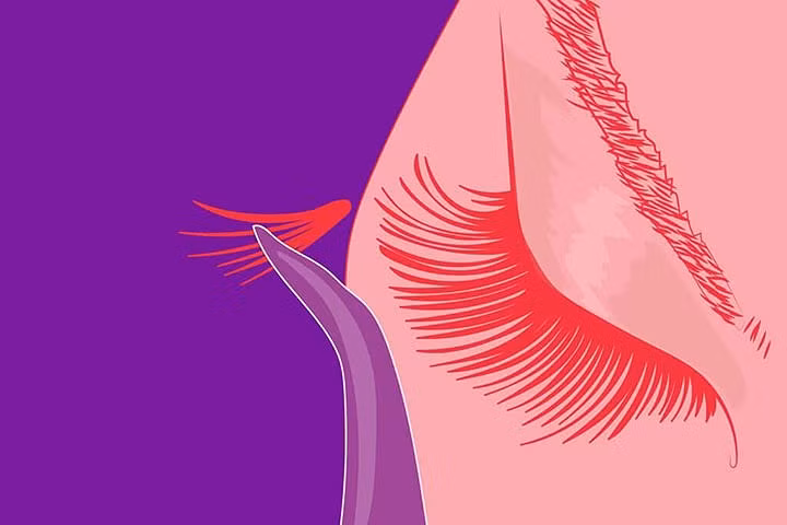 Sử dụng lông mi giả: Việc lạm dụng lông mi giả sẽ dẫn đến những hậu quả ngoài mong muốn, lớp keo dính khá chắc chắn ấy sẽ làm ảnh hưởng đến những sợi lông mi thật, do đó khi gỡ lông mi giả ra thì nó cũng kéo theo một lượng lông mi thật. Do đó, bạn không nên gắn mi giả quá thường xuyên và luôn luôn đi đến một salon có uy tín.