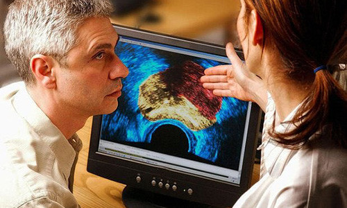 Tuổi thơ được chăm sóc y tế tốt gắn liền với mức testosterone cao, "bản lĩnh đàn ông" khi trưởng thành và... ung thư tuyến tiền liệt liên quan mật thiết- ảnh: THE TELEGRẠPH