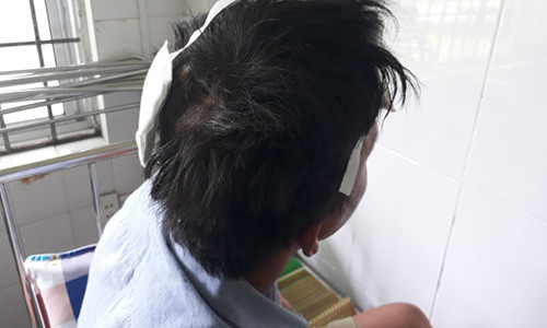 Anh A. với vết thương trên đầu.