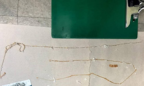 Con sán dây dài 1,67 m ký sinh trong người đàn ông thích ăn sushi. Ảnh: Kenny Banh.