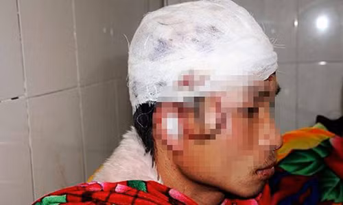 Người đàn ông bị gấu rừng tấn công phải nhập viện đang được các cơ quan chức năng ở huyện Quế Phong xác minh.