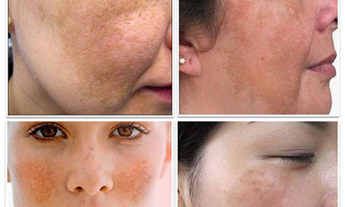 Ảnh minh hoạ: Internet