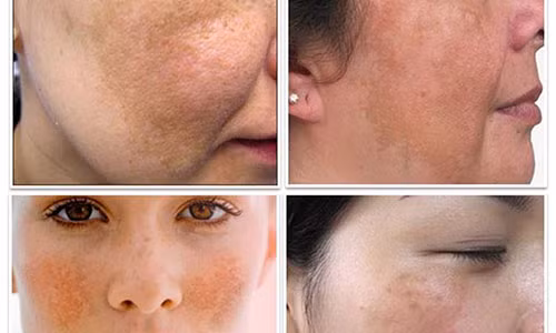 Ảnh minh hoạ: Internet