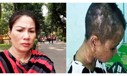 Bà Nguyễn Thị Hà tra tấn người giúp việc Y Nhiêu đến "thân tàn ma dại".