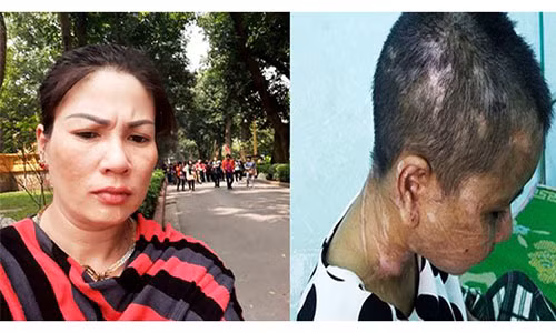 Bà Nguyễn Thị Hà tra tấn người giúp việc Y Nhiêu đến "thân tàn ma dại".