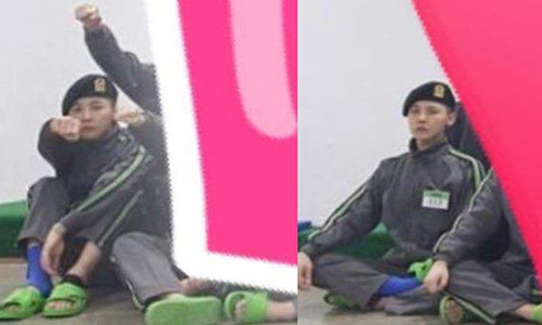 Hình ảnh G-Dragon phải băng bó ở vùng mắt cá chân.