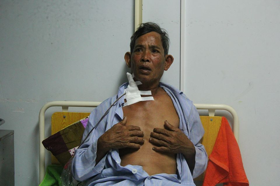 Vac dao dam hang xom nhieu nhat de cuop tien ban bo