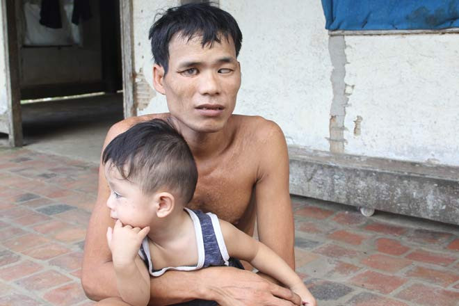 Chuyen tinh “ro ra” giua co nang “chan voi” va anh chang mu-Hinh-2