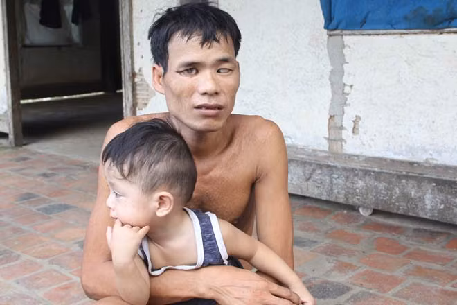 Chuyen tinh “ro ra” giua co nang “chan voi” va anh chang mu-Hinh-2