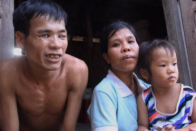 Chuyen tinh “ro ra” giua co nang “chan voi” va anh chang mu-Hinh-3