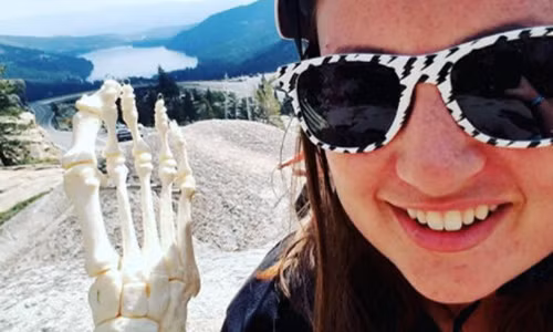 Người phụ nữ đem bộ xương bàn chân mình đi khắp nước Mỹ. Người phụ nữ đem bộ xương bàn chân mình đi khắp nước Mỹ.