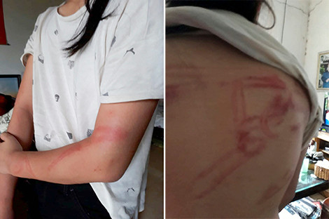 La don keu cuu cua ba ngoai co hai chau bi bo de bao hanh-Hinh-2