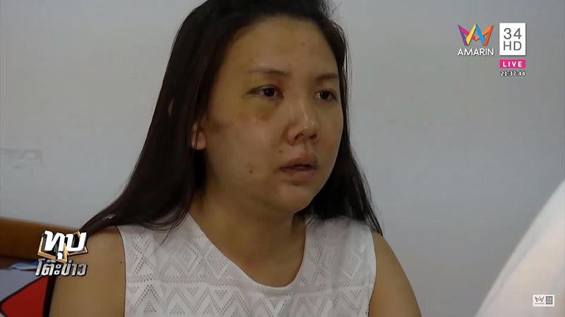 Phang – cô gái bị người yêu đồng tính 7 năm đánh đập dã man nhận được nhiều sự đồng cảm từ cư dân mạng.