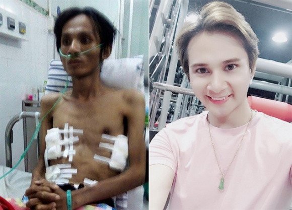 Nhưng sau đó, Thái Lan Viên đã có sự hồi phục thần kì như theo lời bác sĩ nói 1000 người bệnh mới thấy một trường hợp như vậy. Trở về từ bệnh viện, nam ca sĩ Thái Lan Viên đã tăng cân trở lại. Sau hơn 3 năm, hình ảnh bảnh bao, khỏe mạnh, có da có thịt của Thái Lan Viên ở thời điểm hiện tại khiến nhiều người ngỡ ngàng.