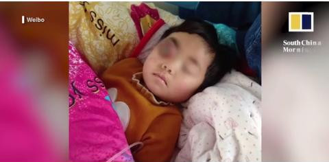 Bé gái đáng thương mắc căn bệnh hiểm nghèo.